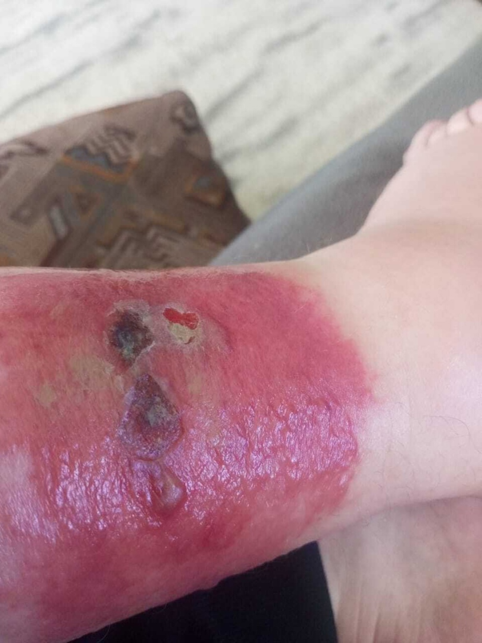 Врачи предупреждают жителей Башкирии о серьезной опасности